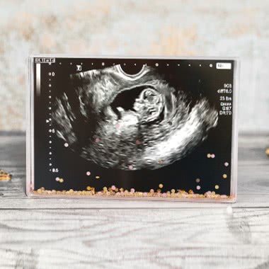 Bewaar je echo in een fotoblok